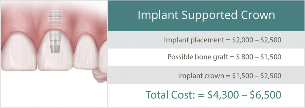 implant supported crown cost