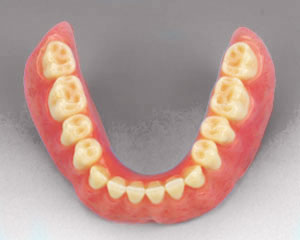 lower-denture-lower-set-edit